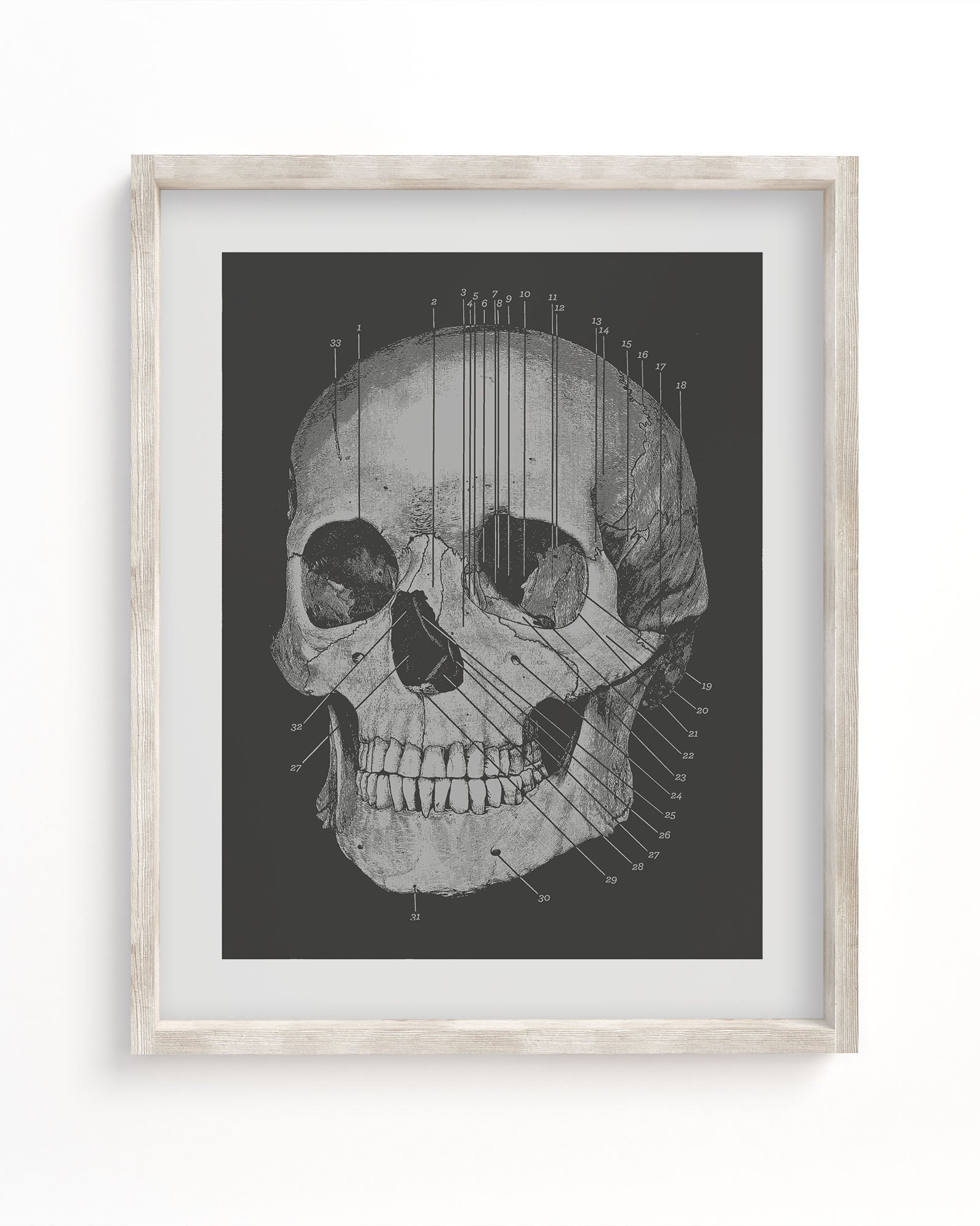 Skull Medical Illustration Museum Print