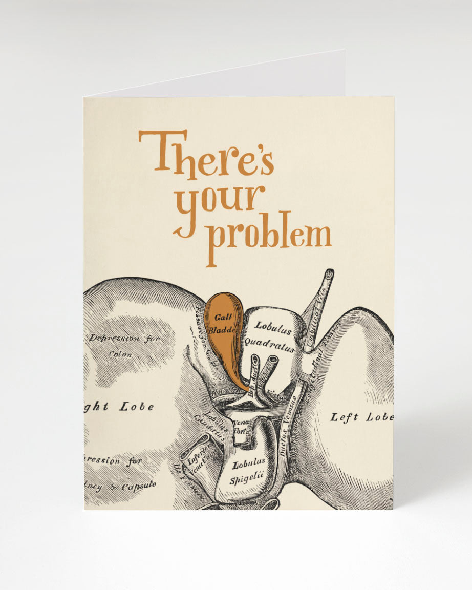 There's your Gallbladder: There's Your Problem Card, by Cognitive Surplus.