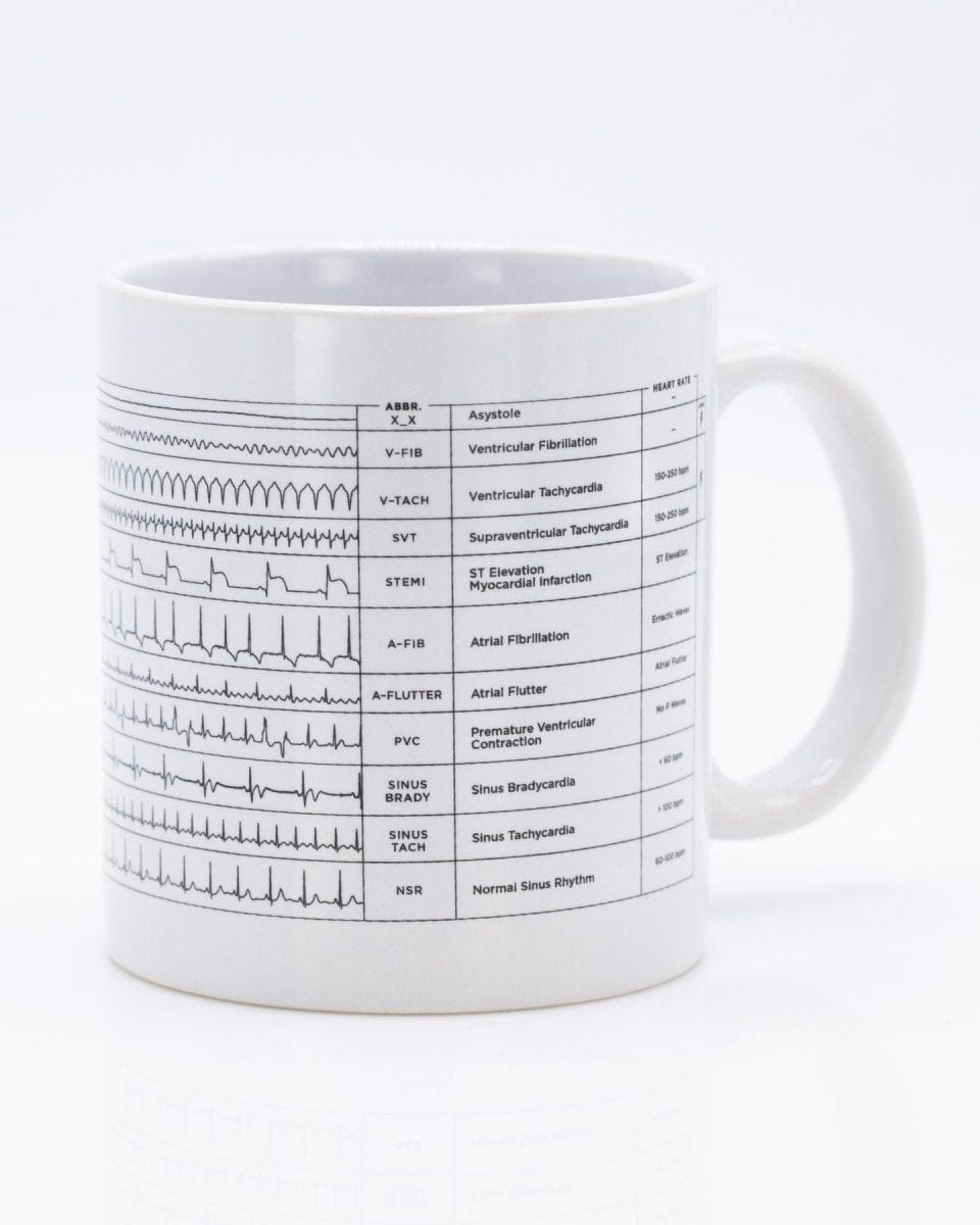 http://cognitive-surplus.com/cdn/shop/products/SECONDS-Heartbeat-20-oz-Mega-Mug-Cognitive-Surplus-882.jpg?v=1659242336