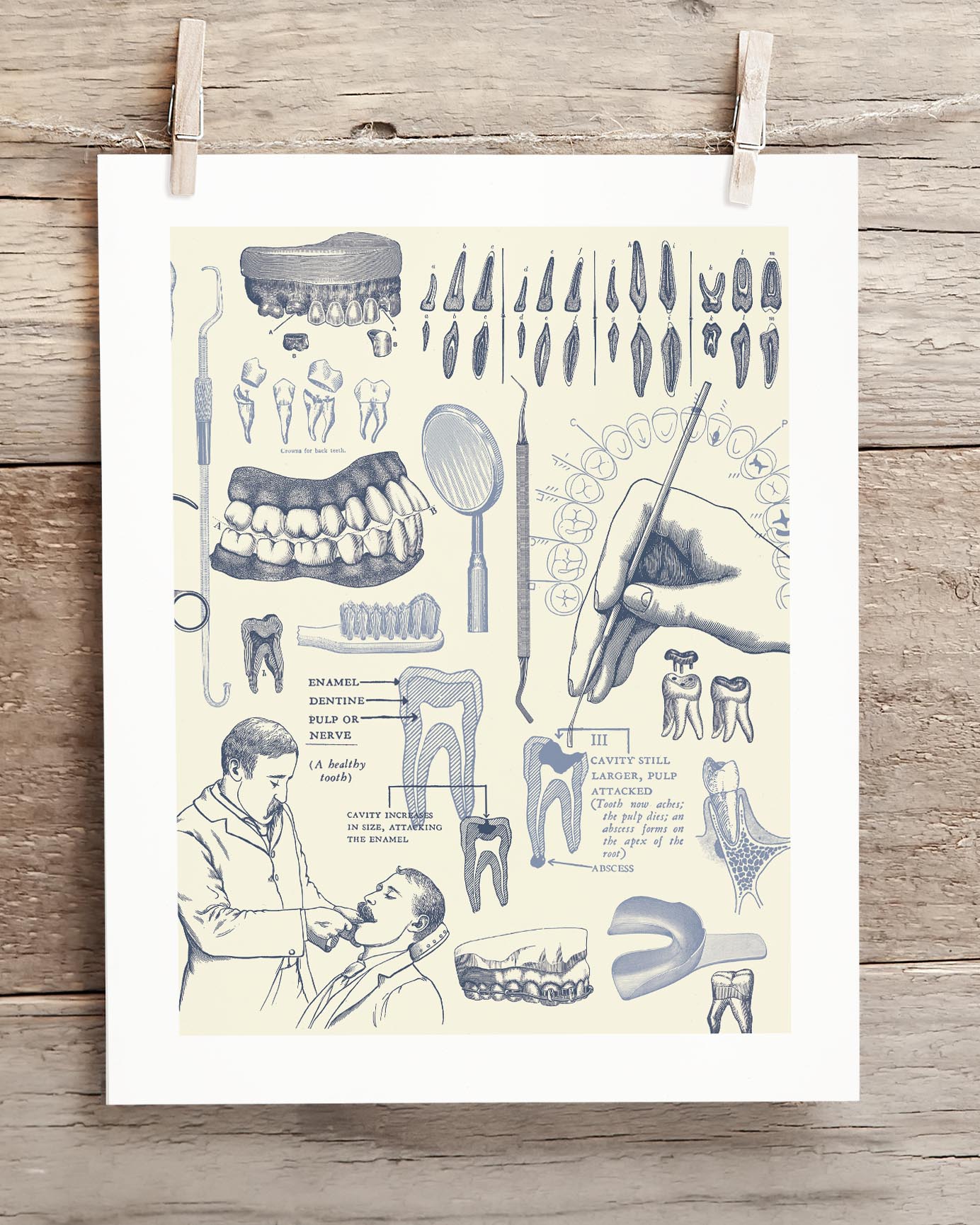 Dentistry Medical Illustration Museum Print